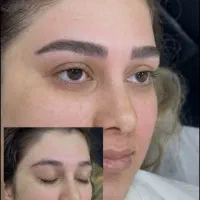 میکرو ابرو نچرال تخصصی