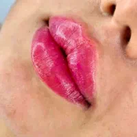 تزریق فیلر و کاشت ناخن|خدمات آرایشگری و زیبایی|خواف, |دیوار