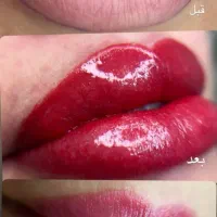 میکرو و شیدینگ لب و ریموو تاتو