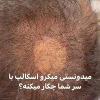 درمان تخصصی ریزش مو و رفع کم پشتی مو|خدمات آرایشگری و زیبایی|قم, صدوق|دیوار