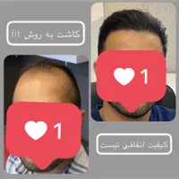 جشنواره  کاشت مو و ابرو شیراز|خدمات آرایشگری و زیبایی|اصفهان, دانشگاه اصفهان|دیوار