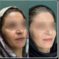 یک مرکز جامع خدمات و آموزش تمام لاین های زیبایی|خدمات آرایشگری و زیبایی|اهواز, پادادشهر|دیوار