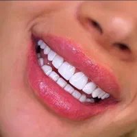 کامپوزیت دندان و دندانپزشکی