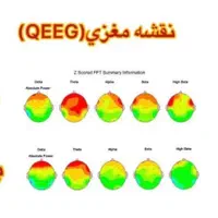 دستگاه نقشه مغزی qeeg