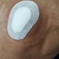 حجامت ، بادکش درمانی، مزاج شناسی|خدمات آرایشگری و زیبایی|اهواز, زیتون کارگری|دیوار