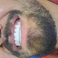 خدمات دندان پزشکی|خدمات آرایشگری و زیبایی|بروجرد, |دیوار