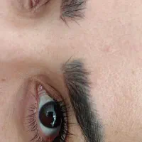 کاشت،لیفت، اکستنشن