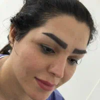 کاشت ابرو طبیعی فقط پانزده تومن