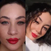 عمل بینی بدون بازگشت