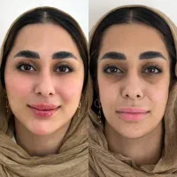 فول فیس