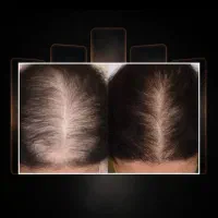 خداحافظی با کم‌پشتی