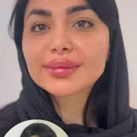 پنجاه درصد تخفیف ژل صورت|خدمات آرایشگری و زیبایی|اهواز, پادادشهر|دیوار