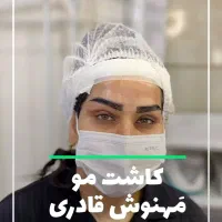 قویترین تیم کاشت مو و ابرو در اهواز