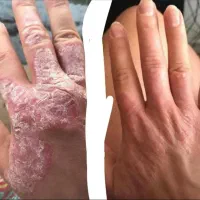 طب سنتی|آرایشی، بهداشتی، درمانی|لردگان, |دیوار