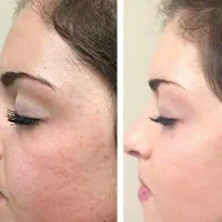 آف پاکسازی پوست صورت