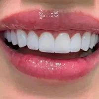 دندان سازی امید