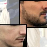 وقتشه. اقدام. کنی. ریش.داشته باشی