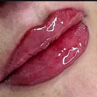 اموزش تتو و ریموو و نیدلینگ صورت و پلاسما جت