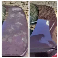 رفع آفتاب سوختگی ،صفر شویی وخدمات مربوطه