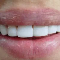 همکاری با دندانپزشک
