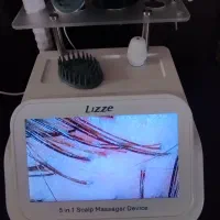 اسکراب اسکالپ پاکسازی کف سر