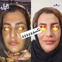 توی ۳ روز سفید برفی و بلوری شو|خدمات آرایشگری و زیبایی|امیدیه, |دیوار