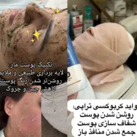 انجام خدمات پوستی هم بانوان و اقایان