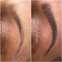 میکروبلیدینگ