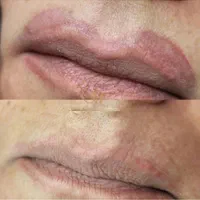ریمو کاملا تخصصی تضمینی با مدرس بین الملی|خدمات آرایشگری و زیبایی|آبادان, |دیوار