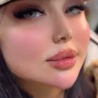 تزریقات ژل و بوتاکس|خدمات آرایشگری و زیبایی|گرگان, |دیوار