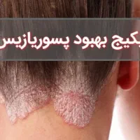 پک بهبود پسوریازیس