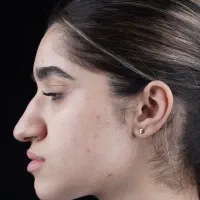 بینی ایده‌آل با اقساط بلندمدت ، پیزوسرجری شیراز در شیراز، فرهنگ شهر، خ رجایی سی و چهارم