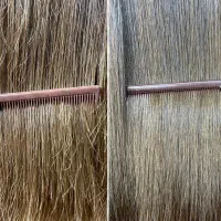 موخوره گیری واصلاح صورت جم