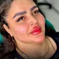 تزریق ژل،بوتاکس،فیلر،مزوتراپی،پی آر پی لیزر  هایفو|خدمات آرایشگری و زیبایی|اردبیل, |دیوار