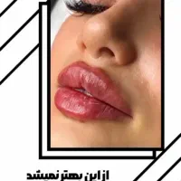 تخفیف ویژه خدمات ژل و بوتاکس|خدمات آرایشگری و زیبایی|زابل, |دیوار