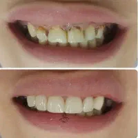 دندانپزشکی، بیمه تکمیلی و بانک، مواد عالی