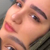 تخفیف ویژه میکروبلیدینگ ژل