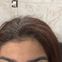 پاکسازی و فیشیال پوست  ازبین بردن لک مخصوص بانوان|خدمات آرایشگری و زیبایی|آمل, |دیوار