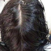 اولین و تخصصی ترین مرکز پاکسازی رشک و شپش 1جلسه