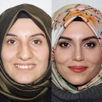 جراحی عمل بینی ۲۴ میلیونی/رینوپلاستی/بینی فانتزی|خدمات آرایشگری و زیبایی|تهران, مطهری|دیوار