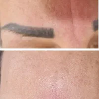 هایفو بوتاکس ژل لب زاویه سازی فیلر بادی هیپ سینه|خدمات آرایشگری و زیبایی|تهران, نارمک|دیوار