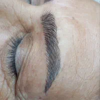 کاشت میکرو باقلم و دستگاه|خدمات آرایشگری و زیبایی|زهک, |دیوار