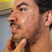 خدمات لیزر،بوتاکس،ماساژ،فیلر لب در شریعتی قلهک|خدمات آرایشگری و زیبایی|تهران, قلهک|دیوار