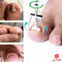 دستگاه اصلاح ناخن ارتودنسی