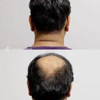 اگه قصد کاشت داری صبر کن
