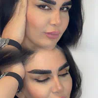 فیبروز به سبک میکروکاشت