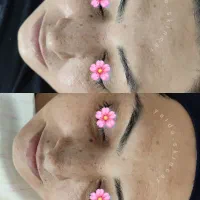 ارائه خدمات تخصصی پوست برای خانم ها