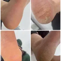 پدیکور وکفسابی پا