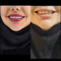 مرکز دندانپزشکی اسپی دنتال