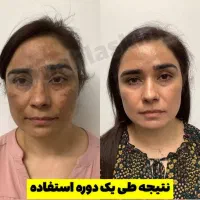 لک و تیرگی|آرایشی، بهداشتی، درمانی|گوهرکوه, |دیوار